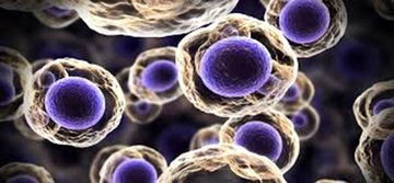 Anüs Kanseri Belirtileri ve Tedavisi